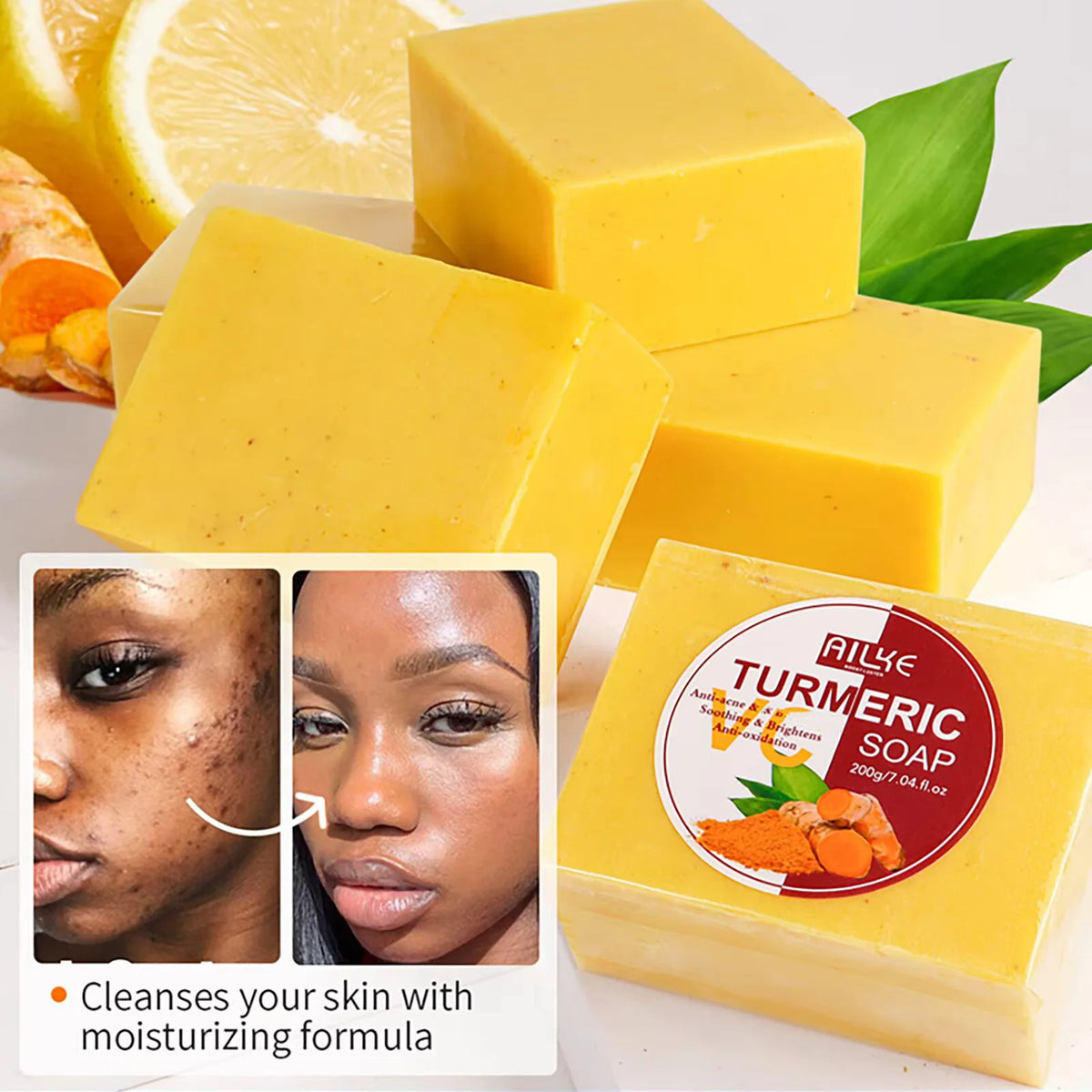 AILKE Natural Turmeric Bath Soap for Face, Body, Hands, Lightening, Cleaning, Even Skin Tone, Anti Dark Spots and Acne, 200g